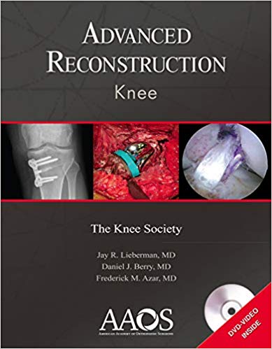 Advanced Reconstruction: Knee